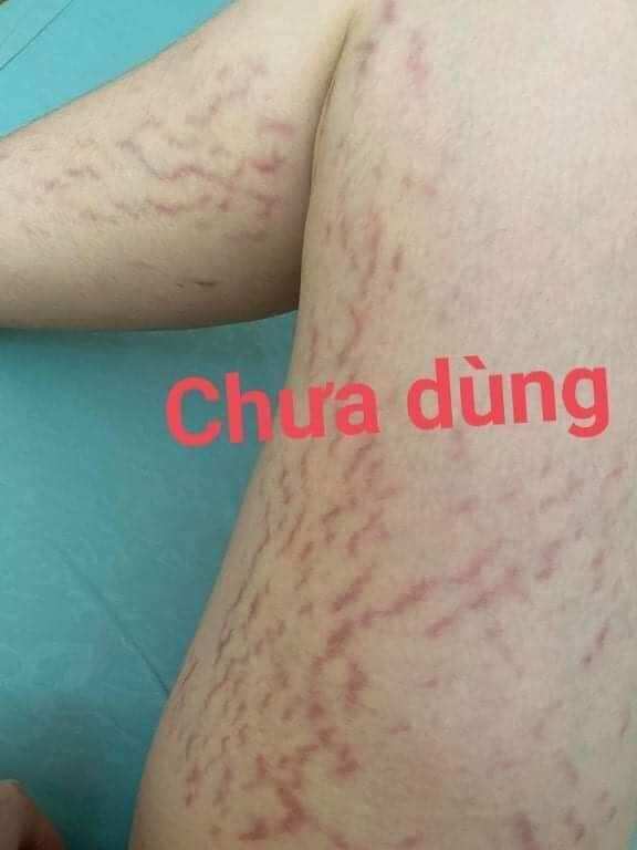 Combo 20 hũ kem Multi 16 loại 20g