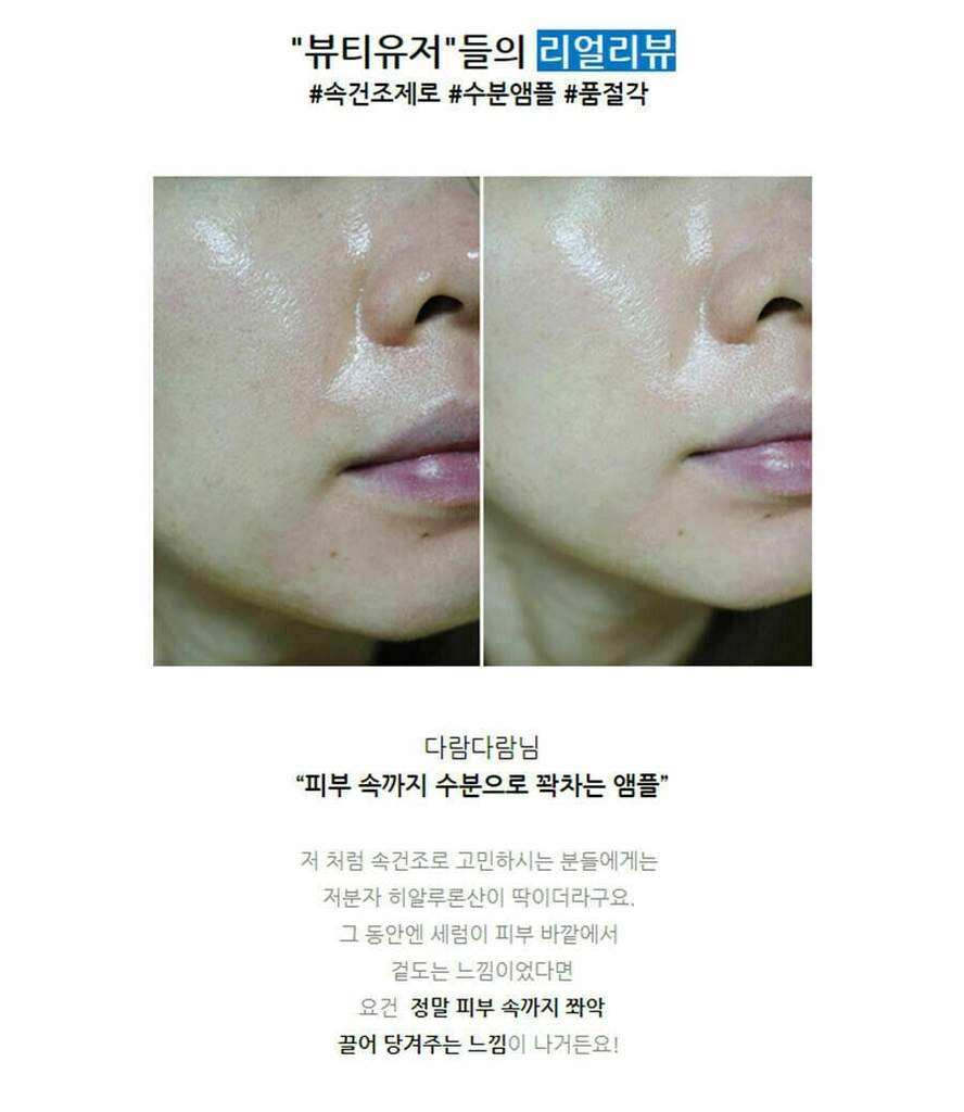 Tinh chất cấp nước phục hồi da Torriden Dive in serum 50ml