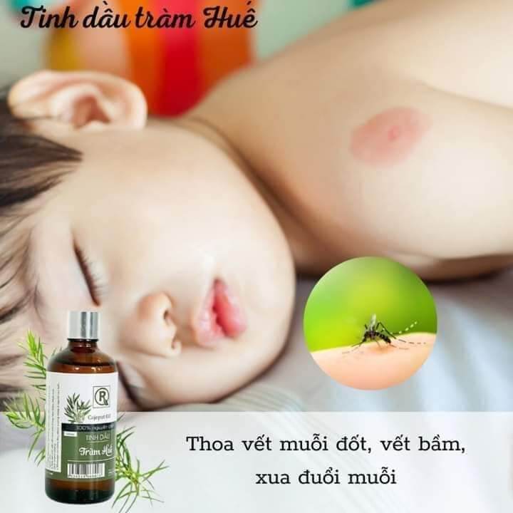 Tinh Dầu Tràm Huế Hồng Tâm
