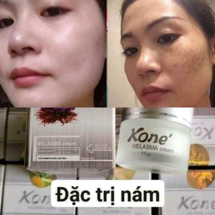 [1 KEM] Kem kone hộp vàng thái lan cho da mụn