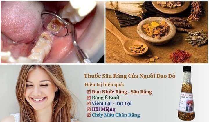 1lọ sâu răng dân tộc dao đỏ loại đậm đặc