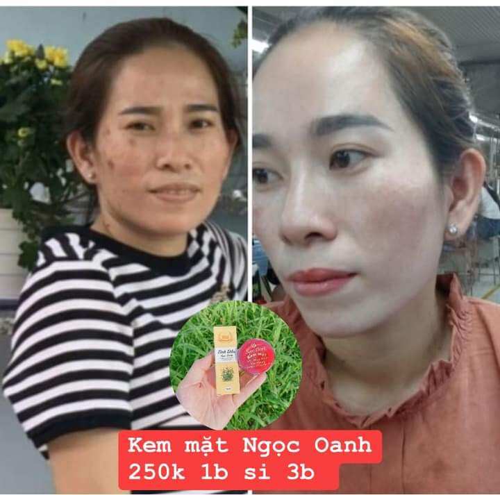Kem mặt ngọc Oanh