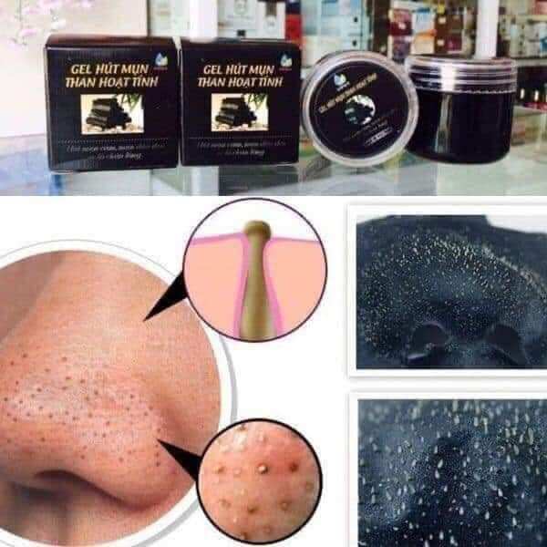 Gel hút mụn than tre ngân bình, Hút sạch mụn đầu đen