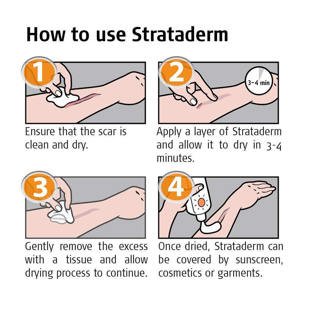 Gel mờ sẹo strataderm 5gr Thụy Sỹ