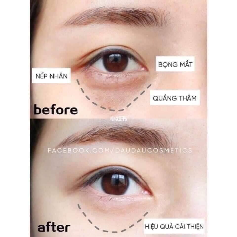 KEM MẮT CLINIQUE 15ml unbox