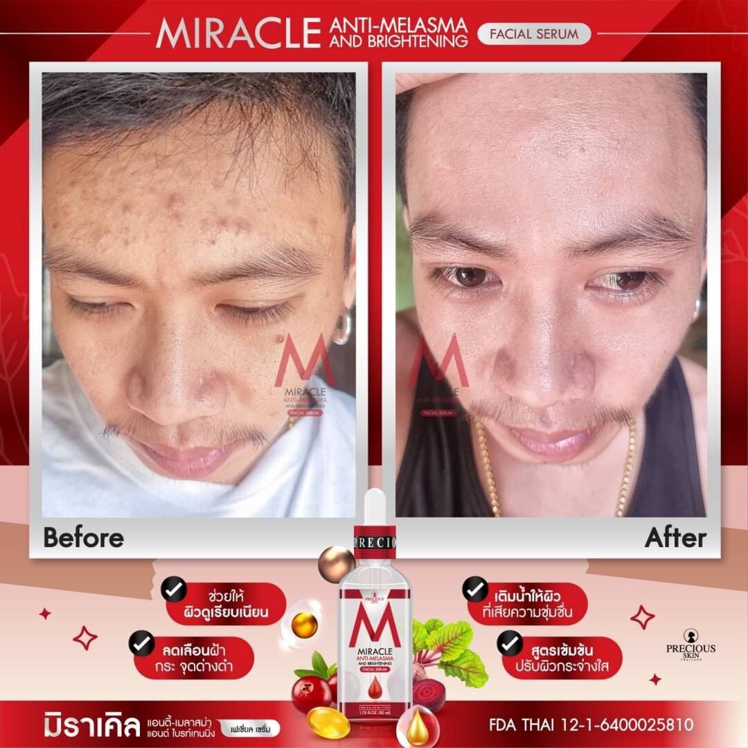 SERUM TÁI TẠO ngừa MỤN THÂM SẠM NÁM MIRACLE
