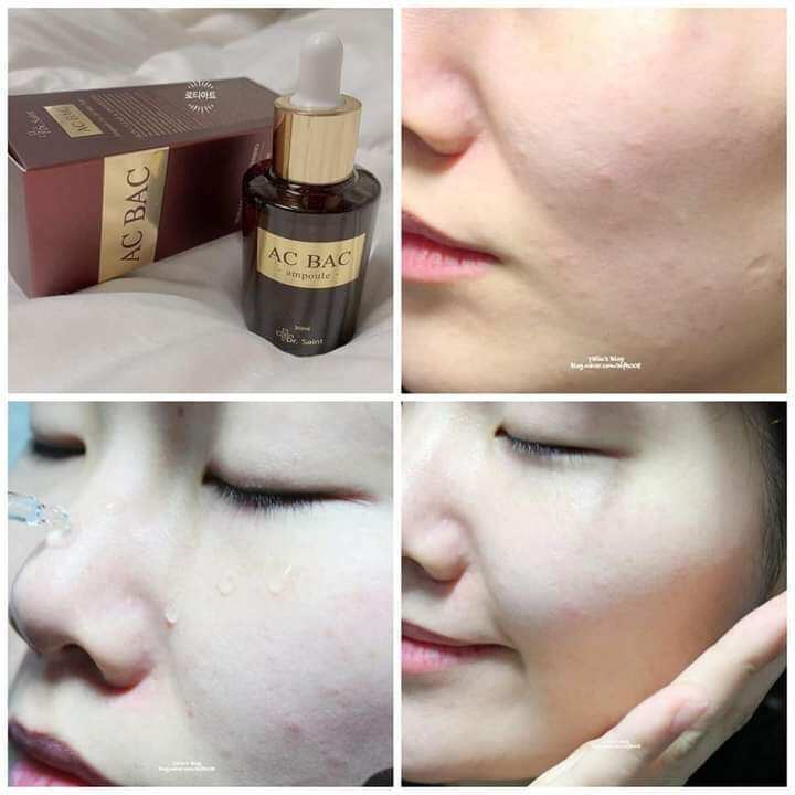 Tinh chất serum  giảm mụn AC BAC