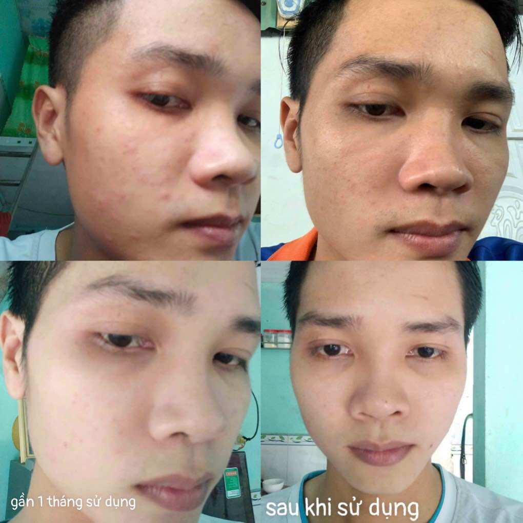Tái Tạo Da Vi Sâm Plus