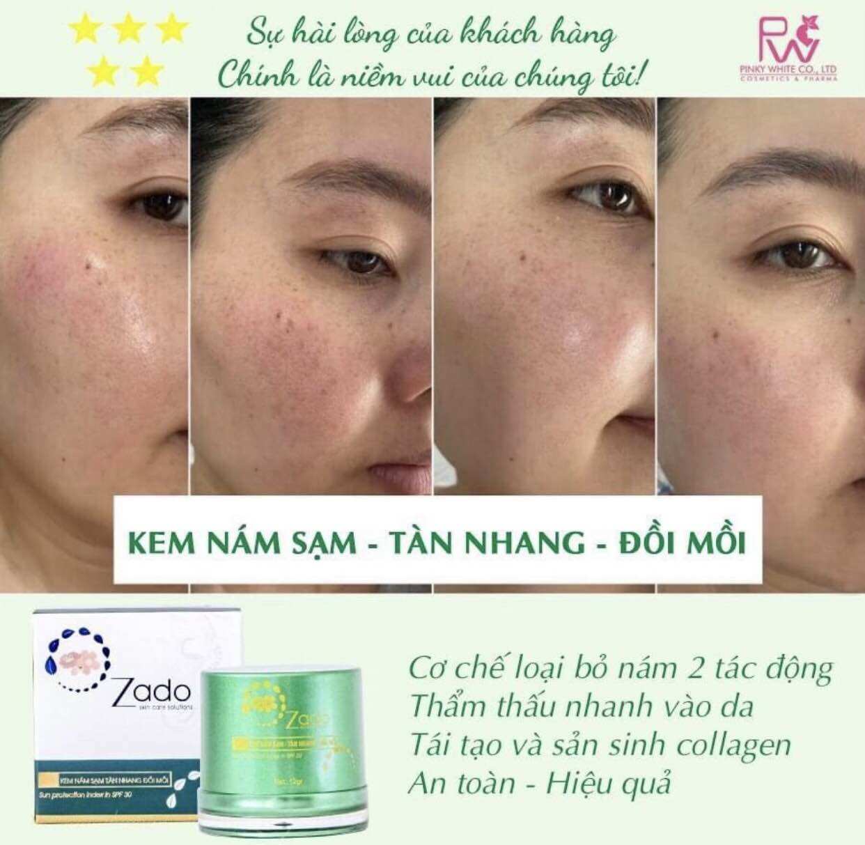 Kem Zado Nám Sạm Tàn Nhang Đồi Mồi ,12gram