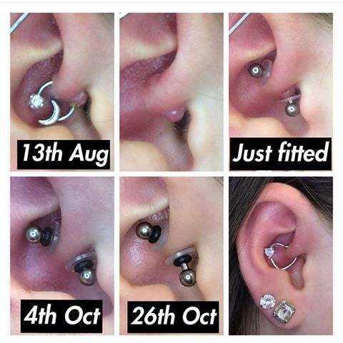 MIẾNG NẸP BUMP - Miếng Nopull Disc (7mm/9mm) - Đệm siết (3mm) - Miếng nẹp bump tai, mũi, rốn, môi, lưỡi,...