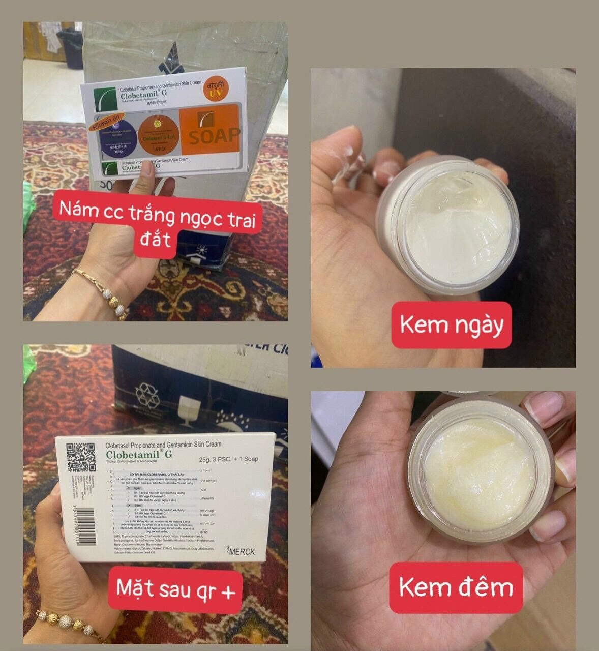 Bộ kem nám cao cấp Clobetamil - G Thái Lan (kem trắng)