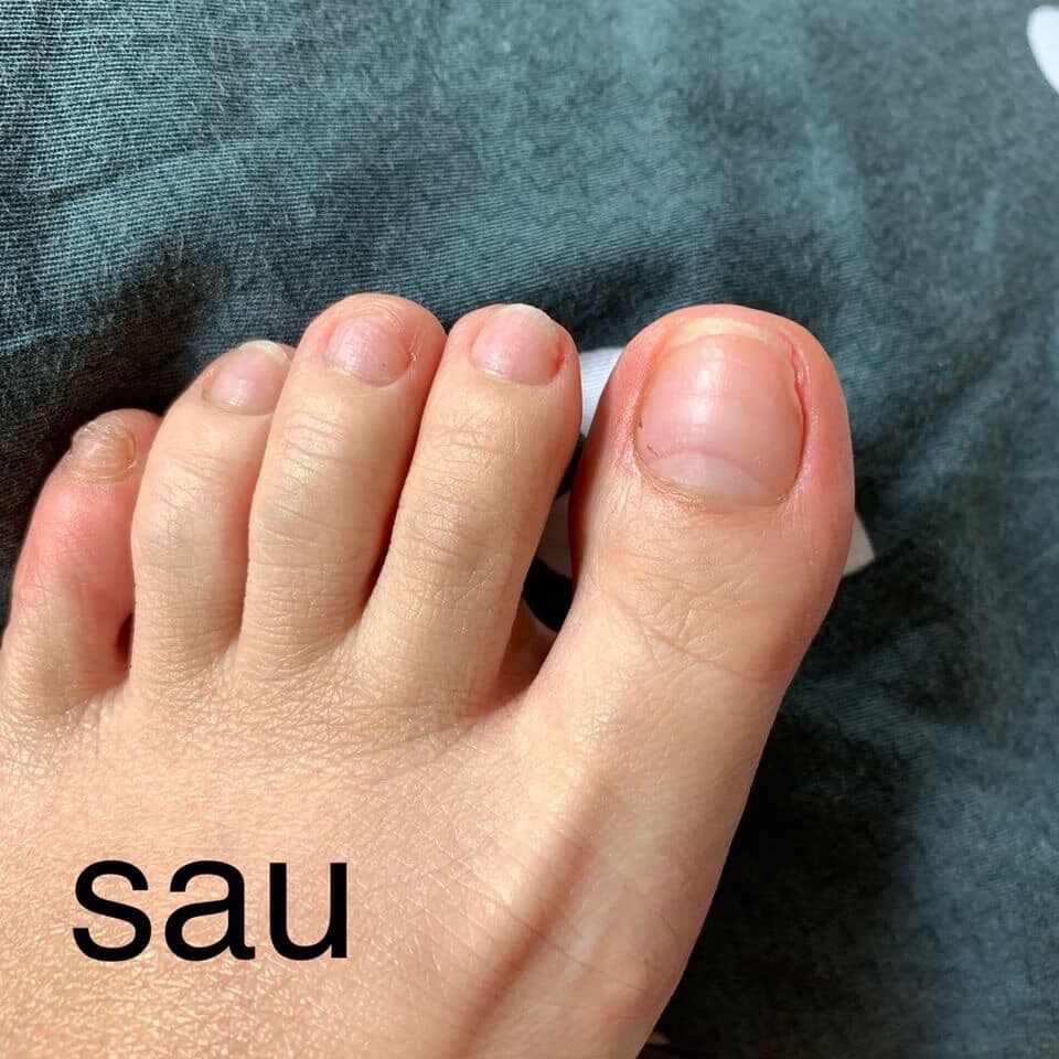 dưỡng phục hồi móng CND