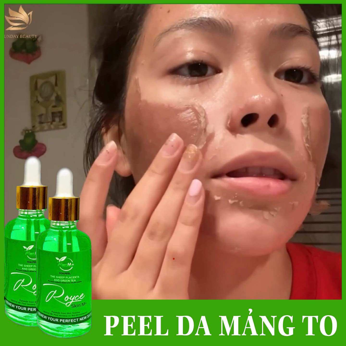 Peel da bong mảng to royce skin m+ peel da - peel da - peel da - peel da