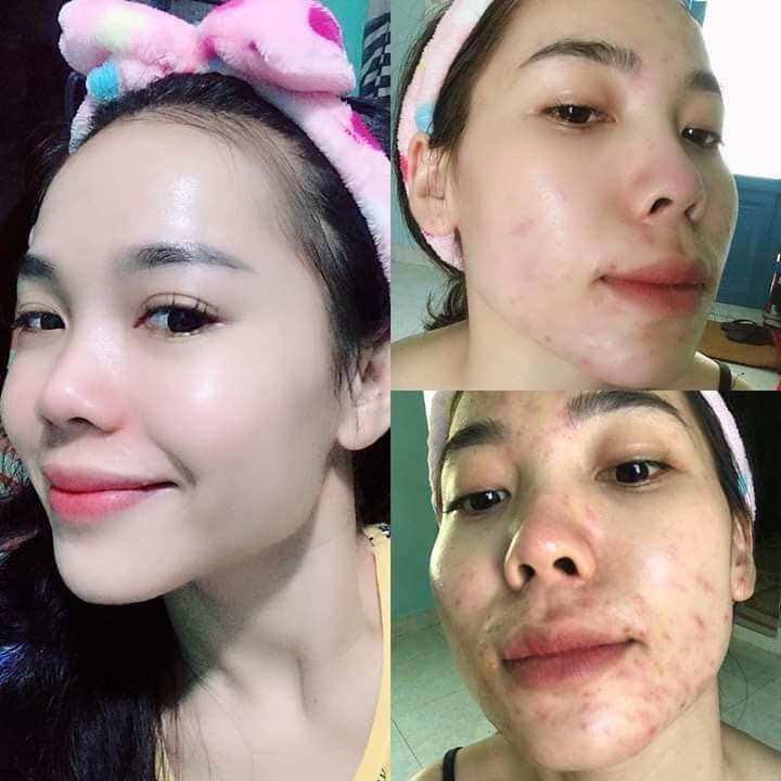KEM SÂM GUOYAO NHẬT BẢN CHÍNH HÃNG