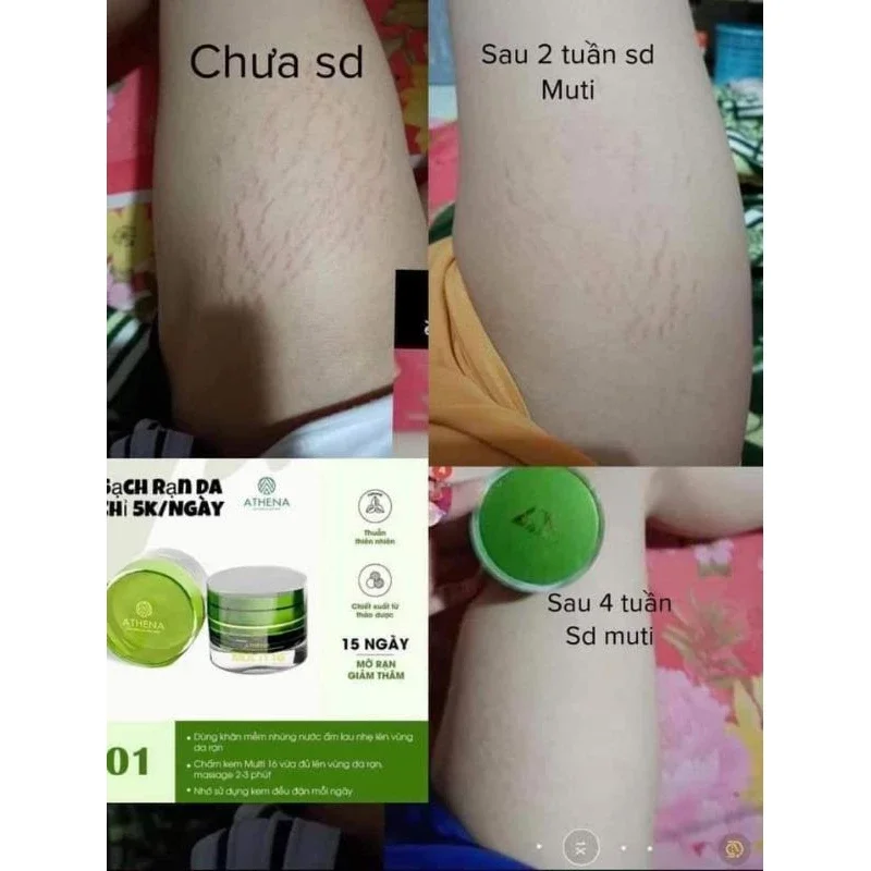 kem rạn da multi 16 loại 30gr