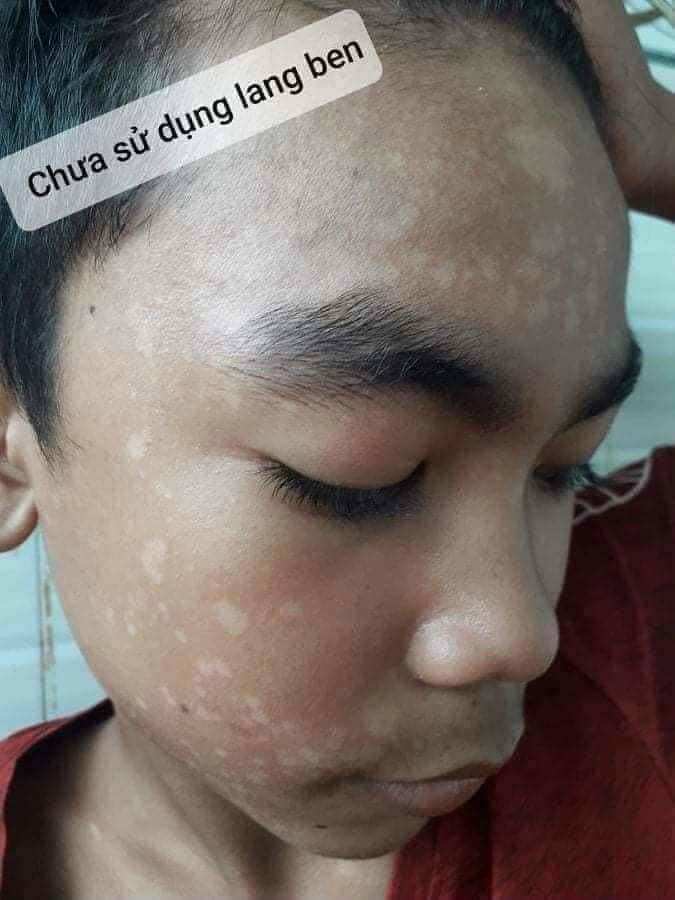 THẢO MỘC LANG BEN TRẦN KIM HUYỀN 15ML