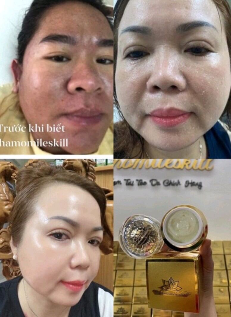 Kem tái tạo vàng Chamomile skill