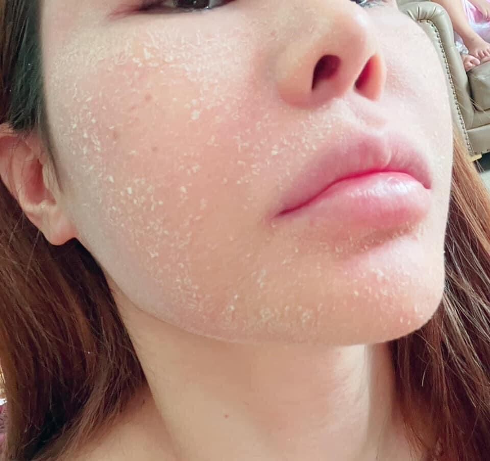 TÁI TẠO DA HỒNG SÂM + BỘT RỬA MẶT <HÀNG CHÍNH HÃNG CTY>