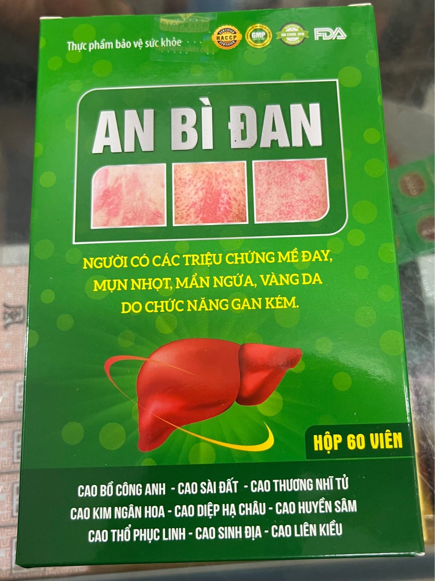 AN BÌ ĐAN DÙNG CHO NGƯỜI MỀ ĐAY MẪN NGỨA