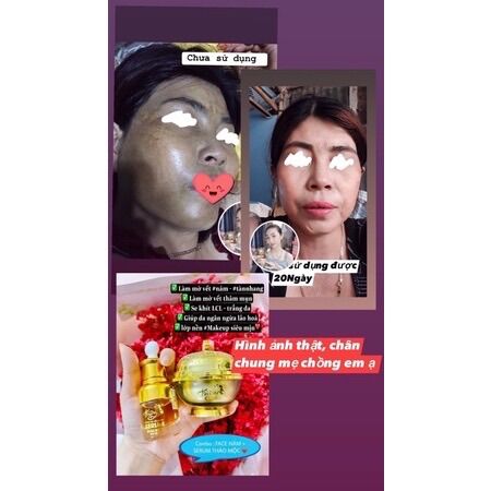 Kem Dưỡng Trắng Da Fairy Cao Cấp