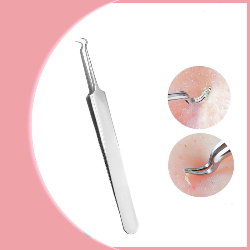 Nhíp cong gắp mụn đầu đen thần thánh