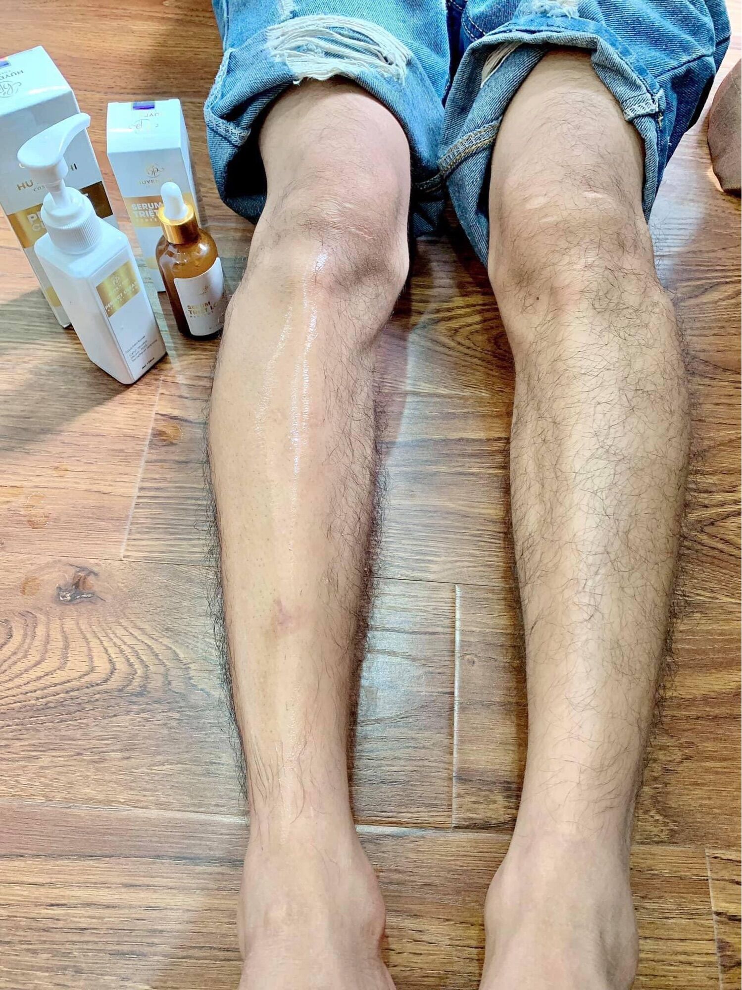 COMBO TẨY LÔNG CAO CẤP HUYỀN PHI - TRIỆT MỌI LOẠI LÔNG