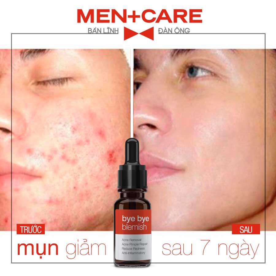 LANGCE TINH CHẤT CHẤM MỤN COLLAGEN+ ĐẸP DA 10ml cho Nam