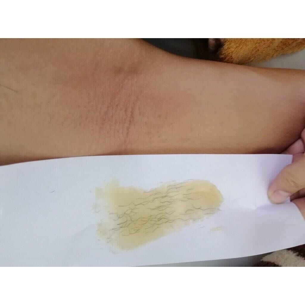 Combo Wax Lông Veo Và Mỡ Trăn Veo Triệt Lông
