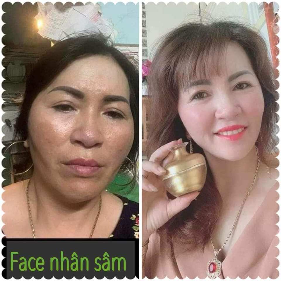 [HCM]Kem face Nhân Sâm Ncollagen(Tặng Kèm Sét Tẩy Tế Bào Chết)