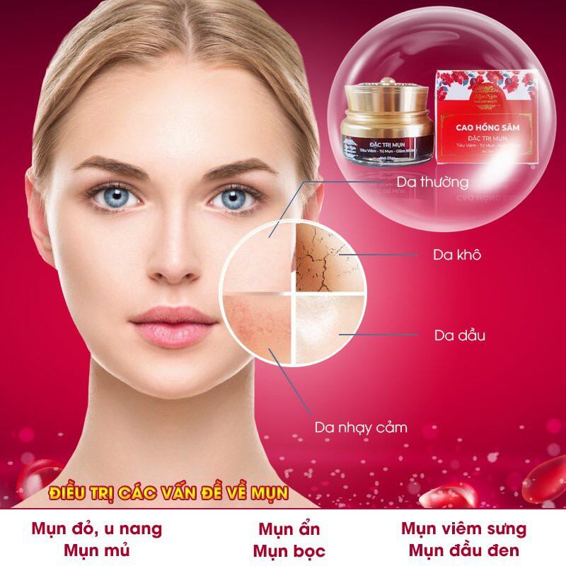 BỘ SERUM & KEM MỤN CAO HỒNG SÂM