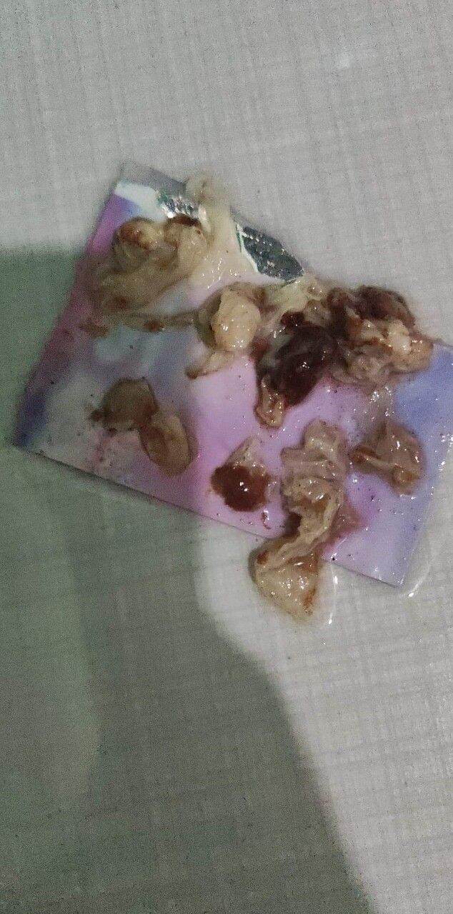 Ngọc nữ tâm vương plus