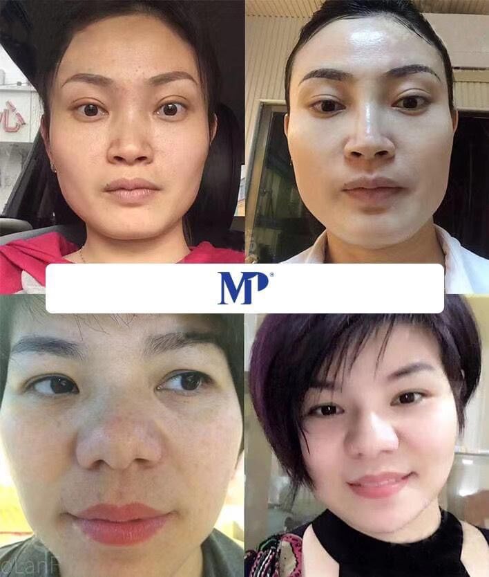 osakura số 2 thuỷ kim luverio