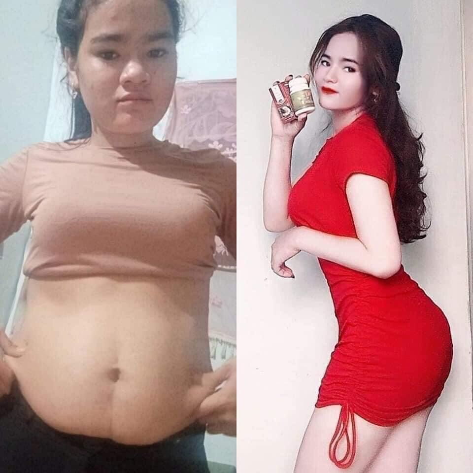 Xổ mỡ vành ruột linh chi đỏ