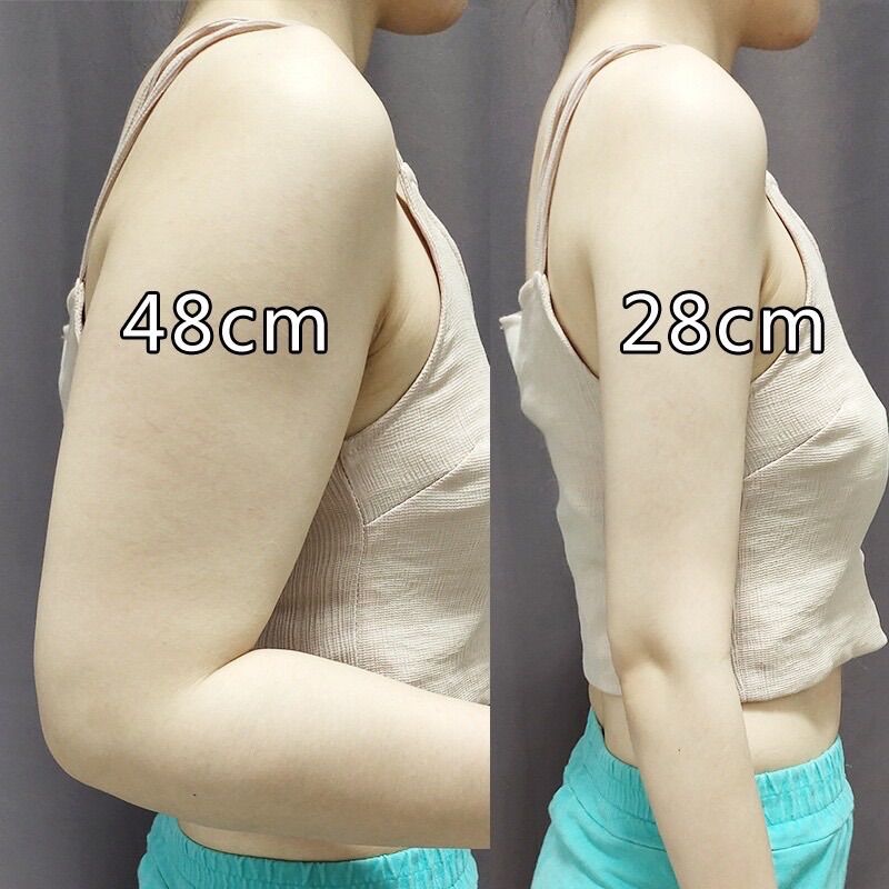 Đai thon bắp tay , thu gọn mỡ bắp tay