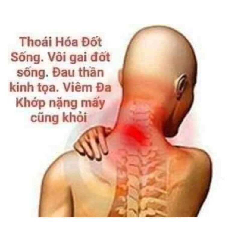 XOA BÓP XƯƠNG KHỚP TKH