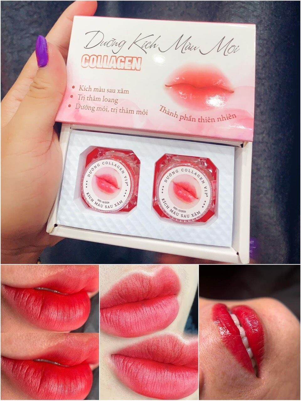 Dưỡng môi - dưỡng kích màu môi collagen vip