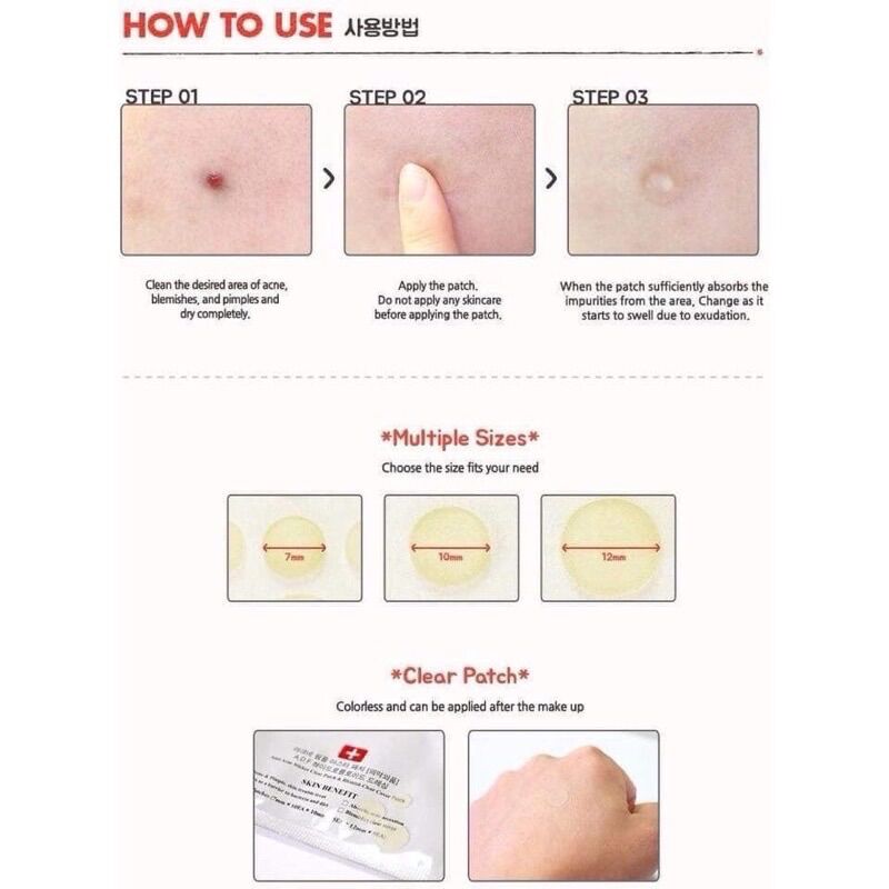 Miếng Dán Mụn Cosrx Acne Pimple / Clear Fit Master Patch (Đỏ-Đen)
