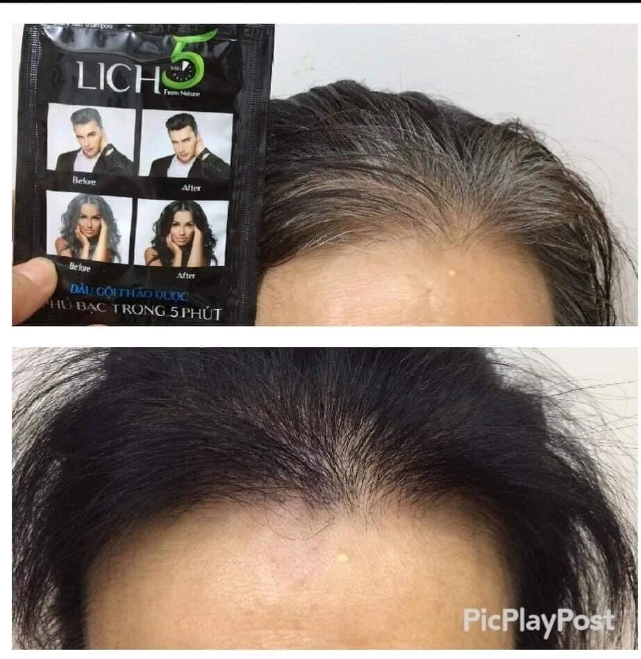 Dầu Gội Thảo Dược Đen Tóc Lich5 Hộp 10 gói