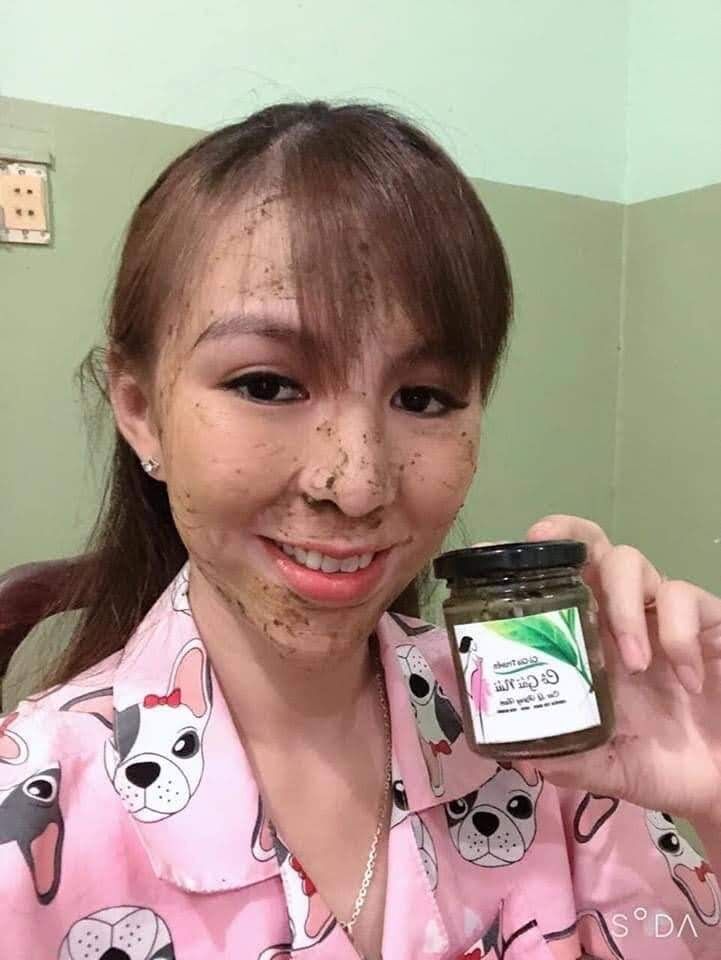 COMBO TRỪ NÁM THẦN THÁNH gồm 4 Sản Phẩm