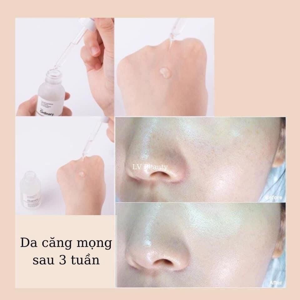 THE ORDINARY HA 2%+B5- SERUM CẤP NƯỚC NGỪA MỤN 30ML