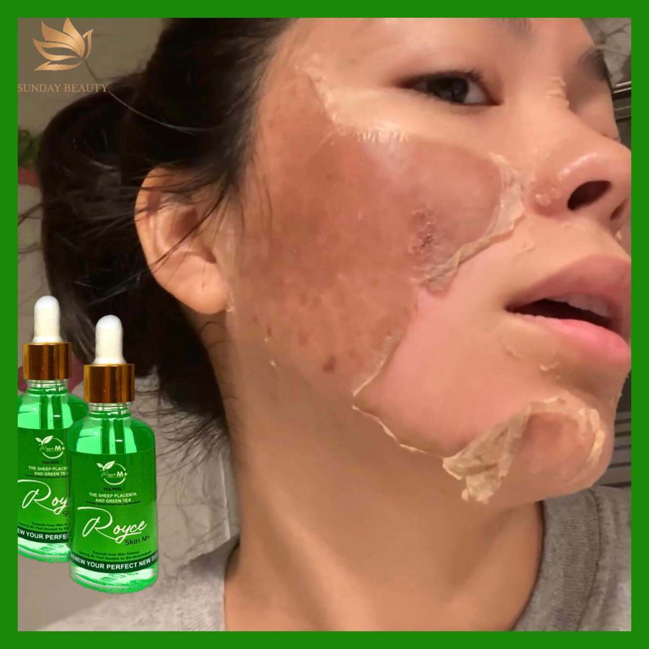 PEEL DA BONG MẢNG TO ROYCE SKIN M+ PEEL DA - PEEL DA - PEEL DA