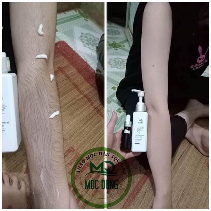 kem triệt lông thảo mộc