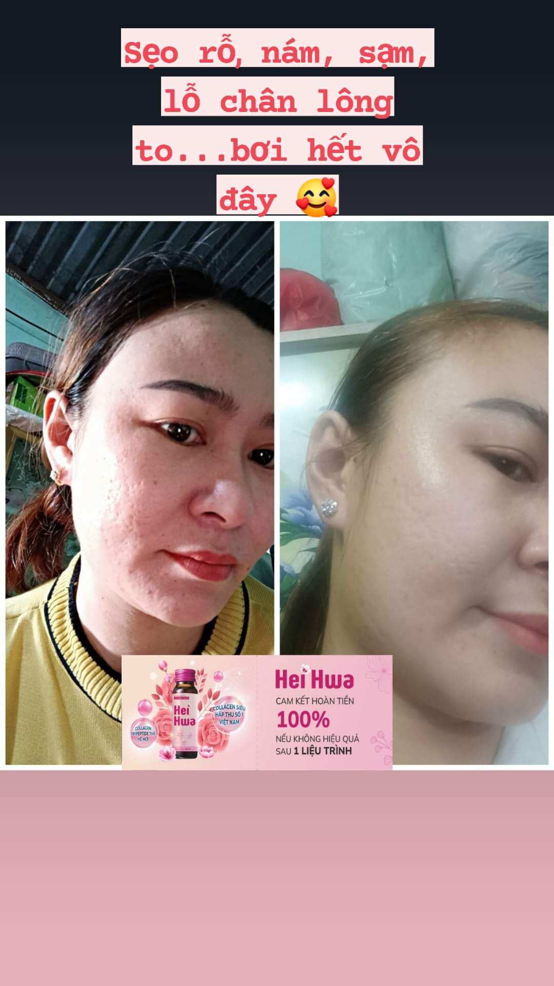 Collagen Tripeptide Hei Hwa siêu hấp thu ( Hộp 10 chai 30ml)