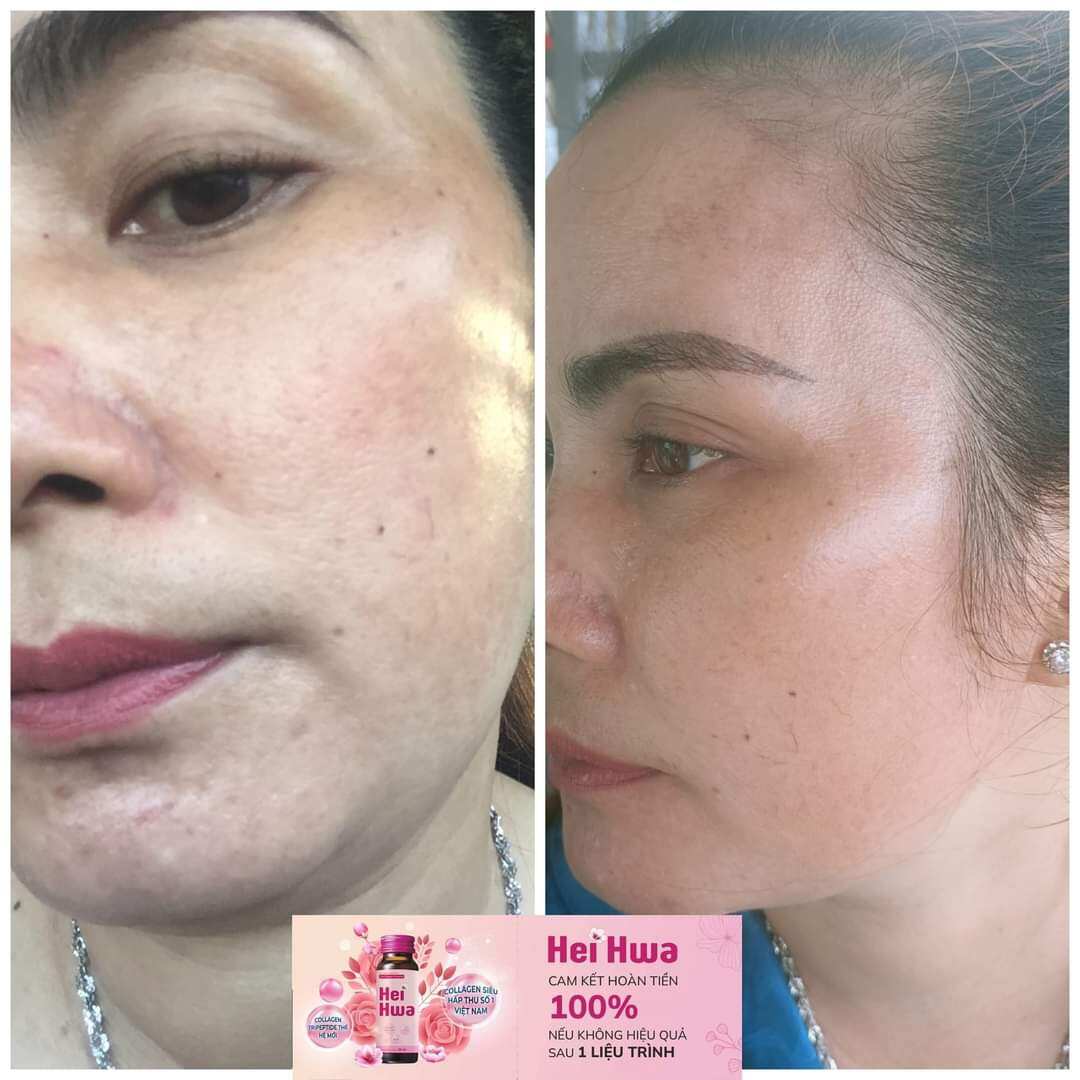 Collagen Tripeptide Hei Hwa siêu hấp thu ( Hộp 10 chai 30ml)