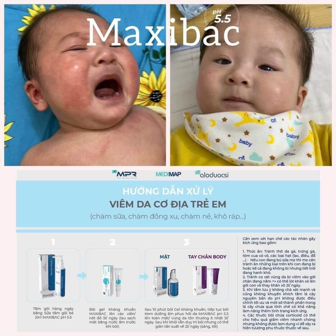 Gel kháng_khuẩn phục hồi da Maxibac