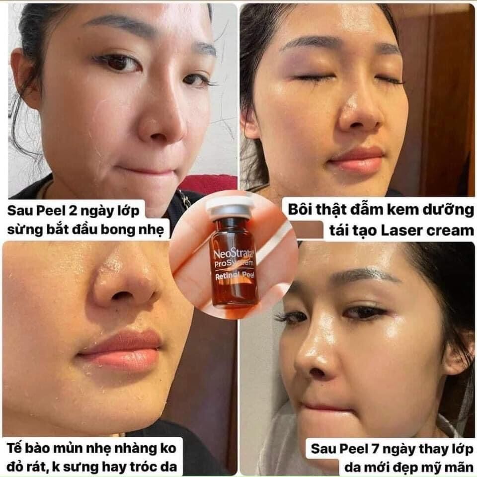 Tinh chất thay da sinh học NeoStrata ProSystem Retinol Peel