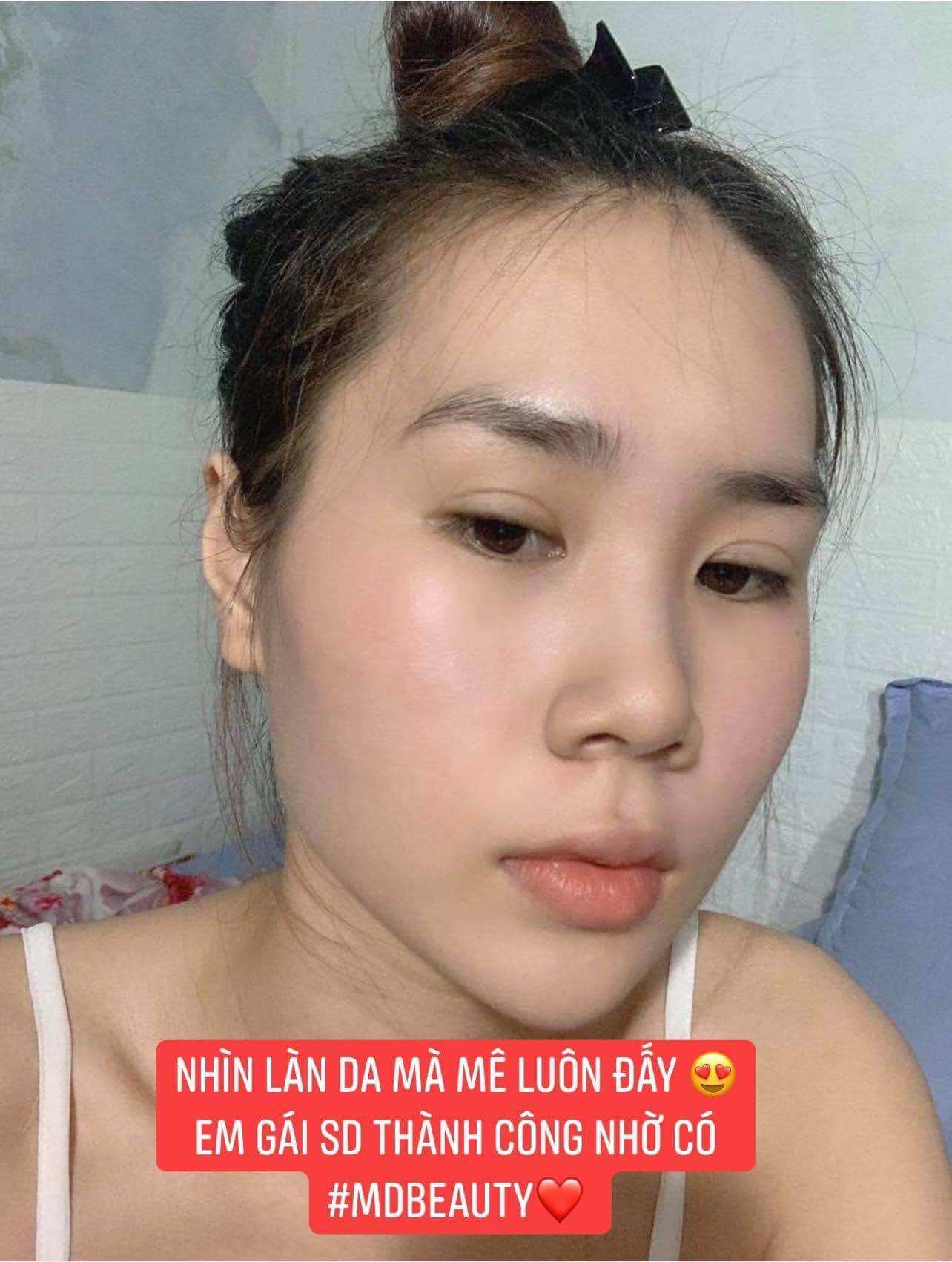 Thuốc bắc tái tạo da mụn