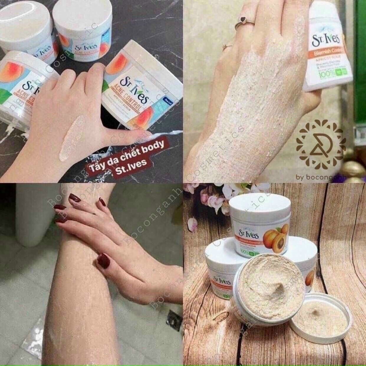TẾ BÀO CHẾT BODY ST IVES