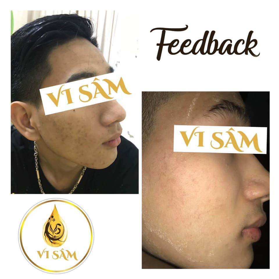 Tái Tạo Da Vi Sâm Plus