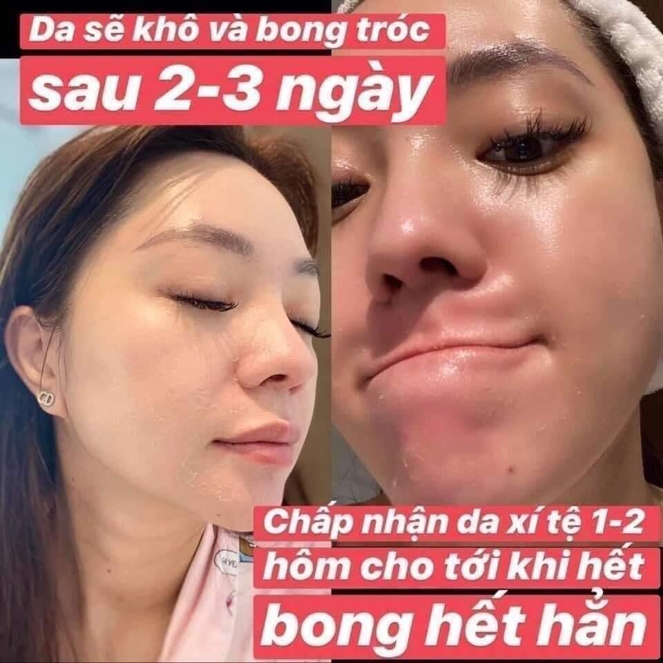 The Ordinary AHA 30% + BHA 2% Peeling Solution